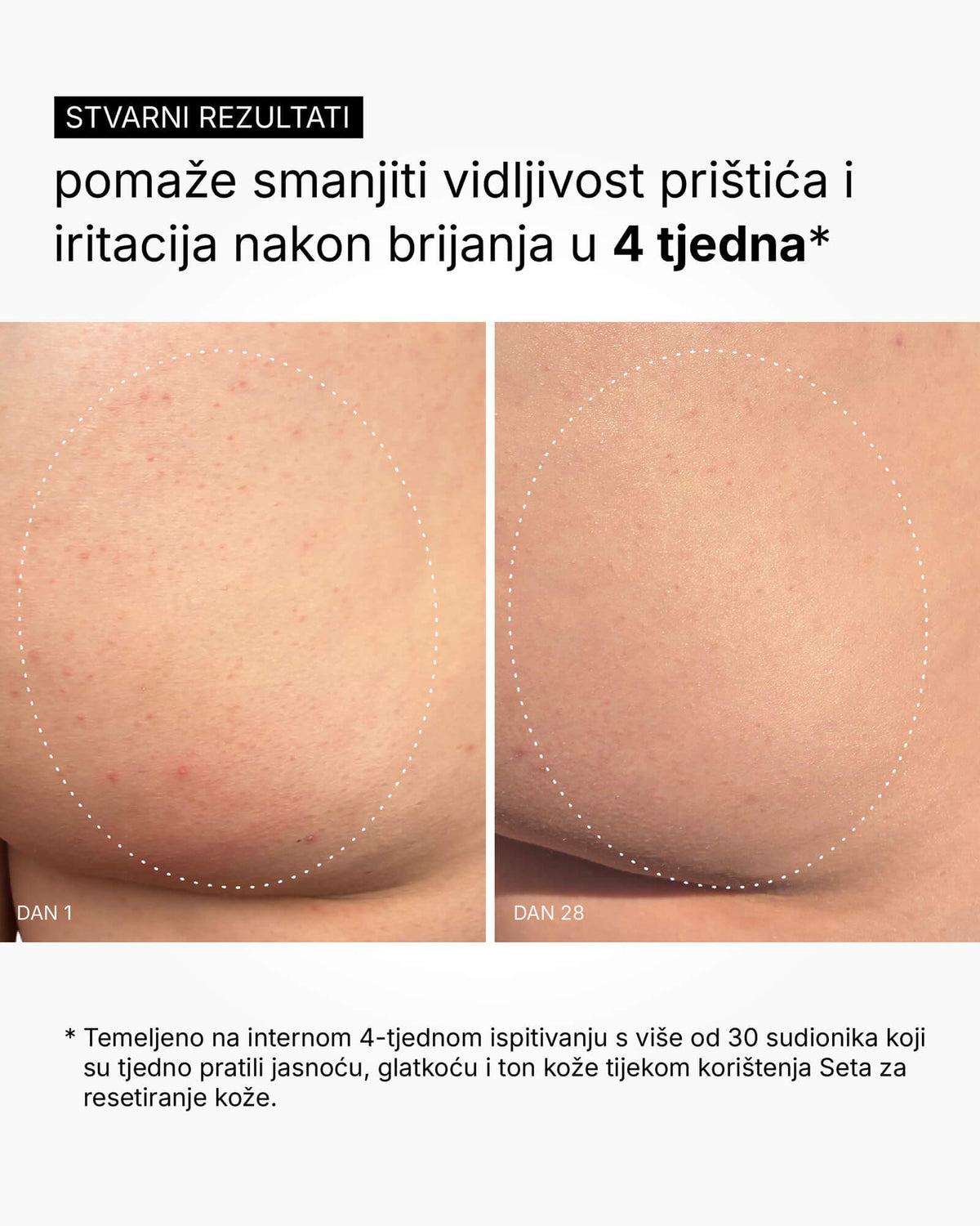 Skin Reset Set - Пълна рутина за тяло