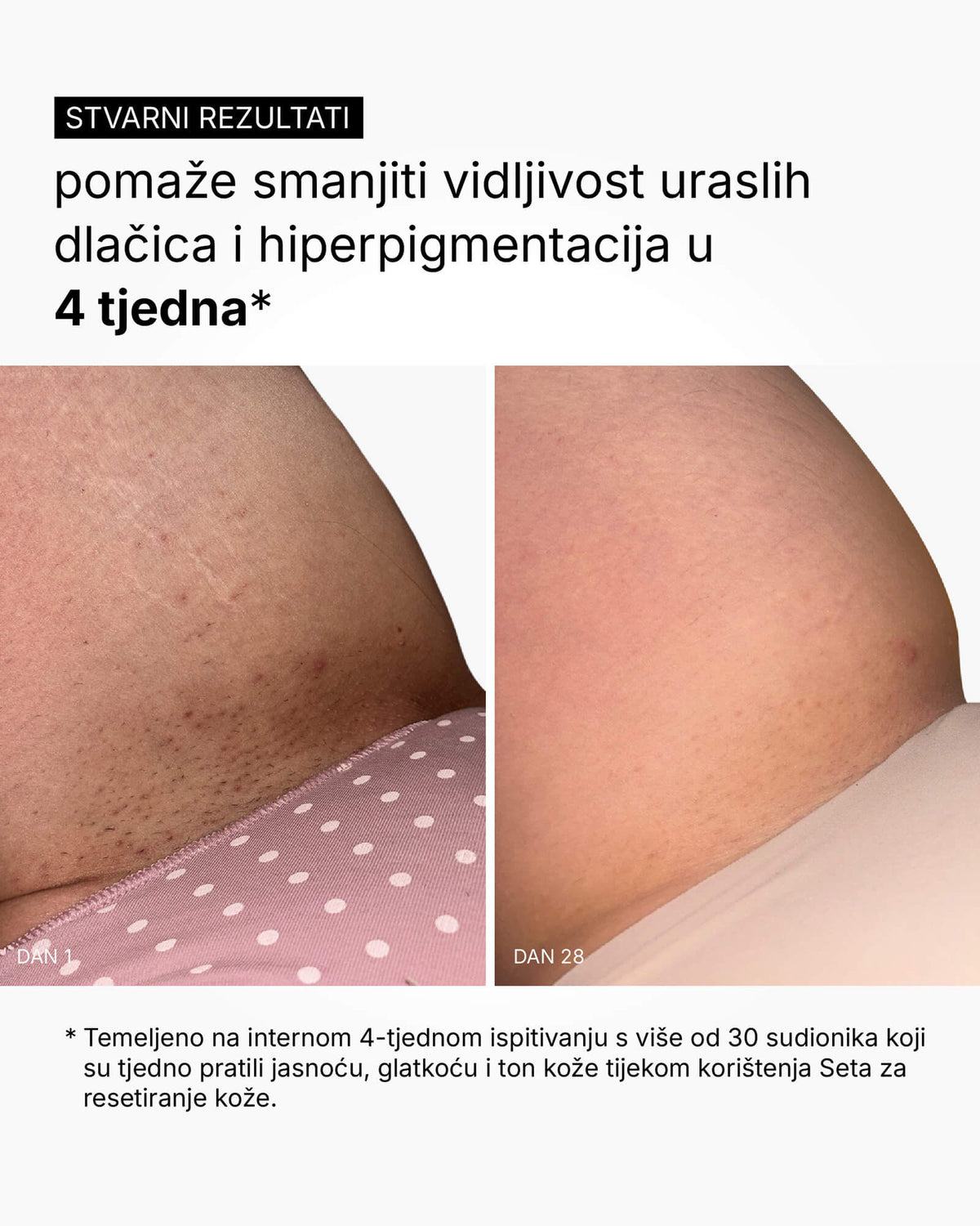 Skin Reset Set - Пълна рутина за тяло
