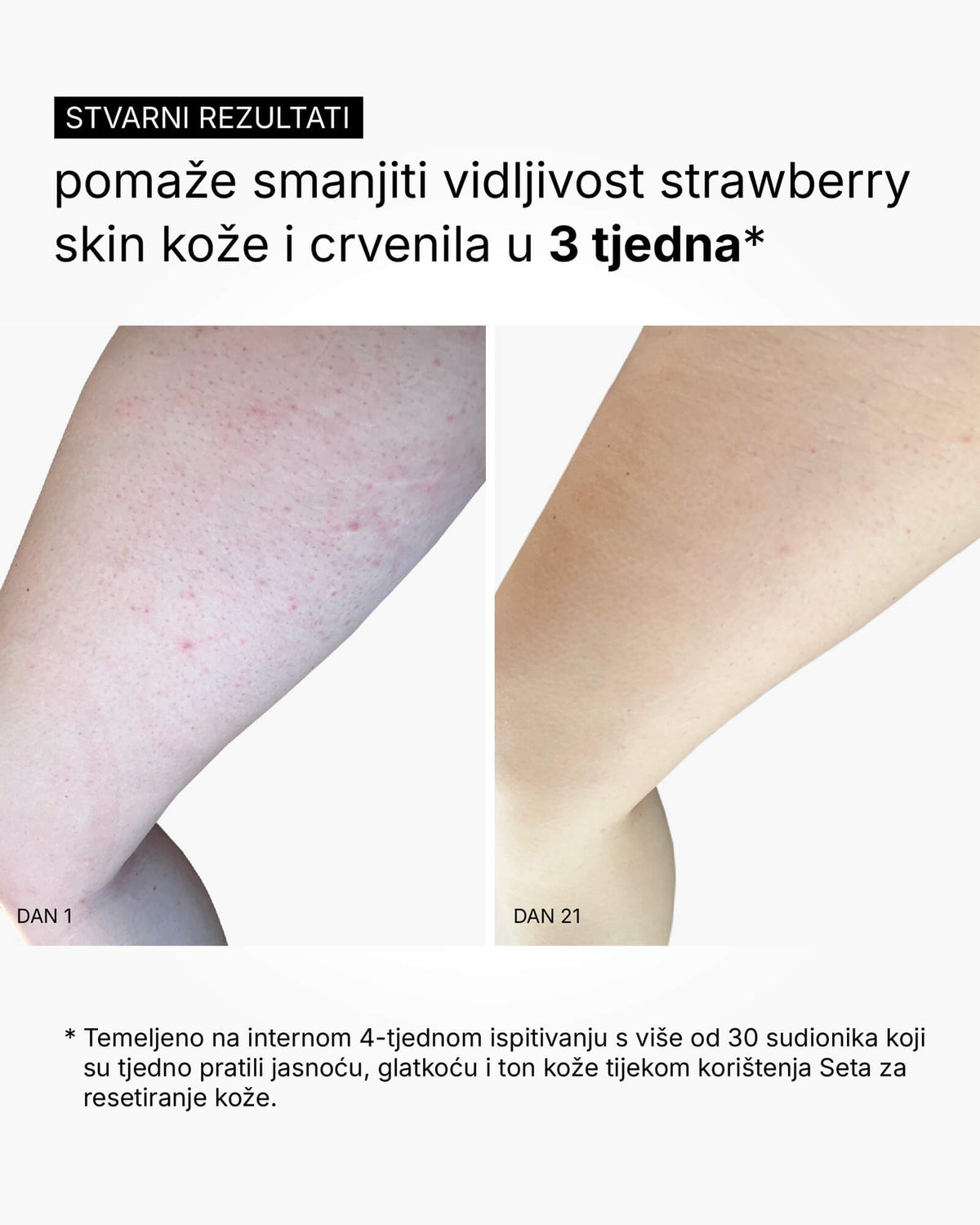 Skin Reset Set - Пълна рутина за тяло