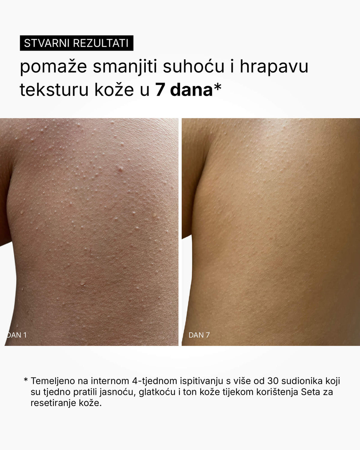 Skin Reset Set - Пълна рутина за тяло