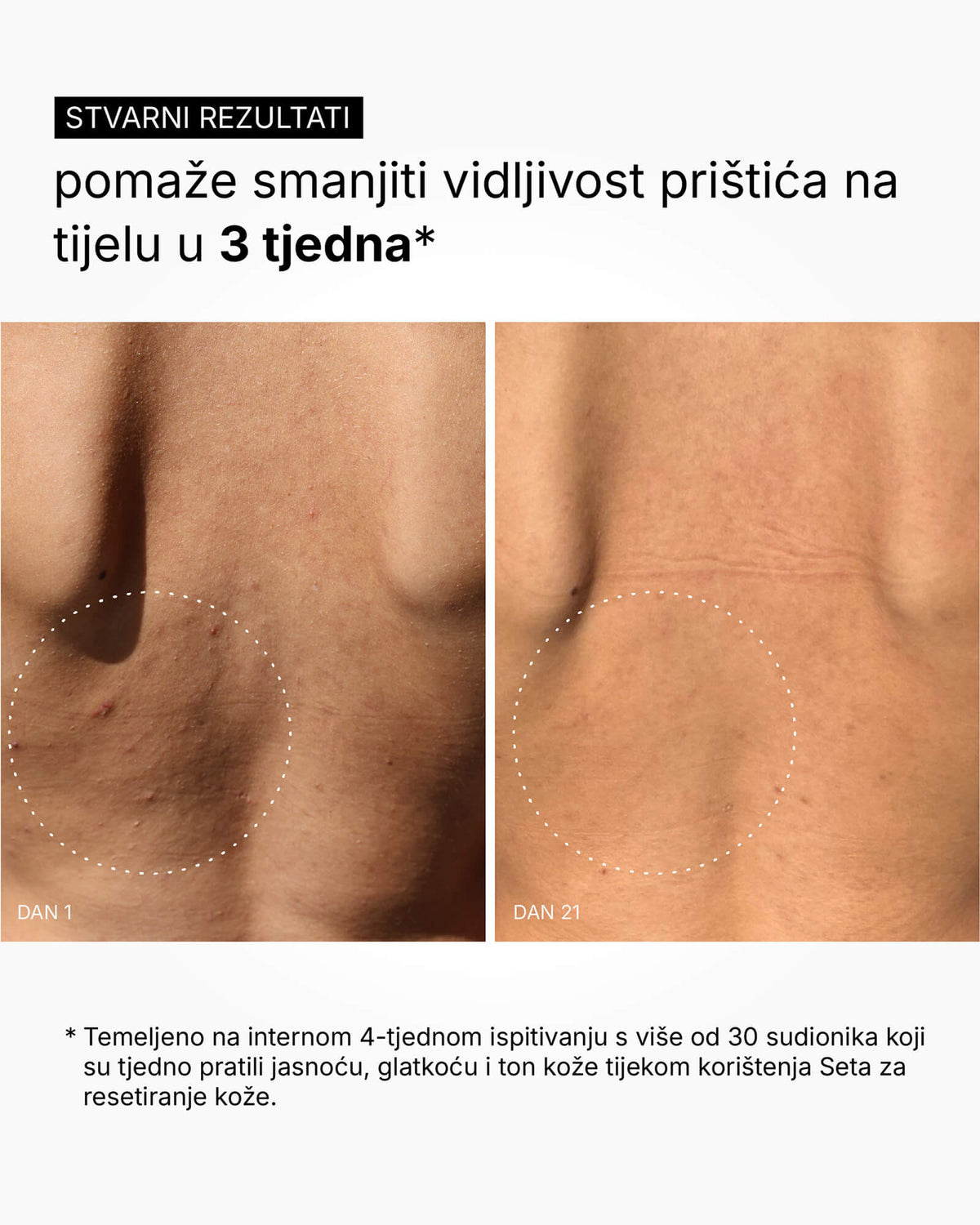 Skin Reset Set - Пълна рутина за тяло